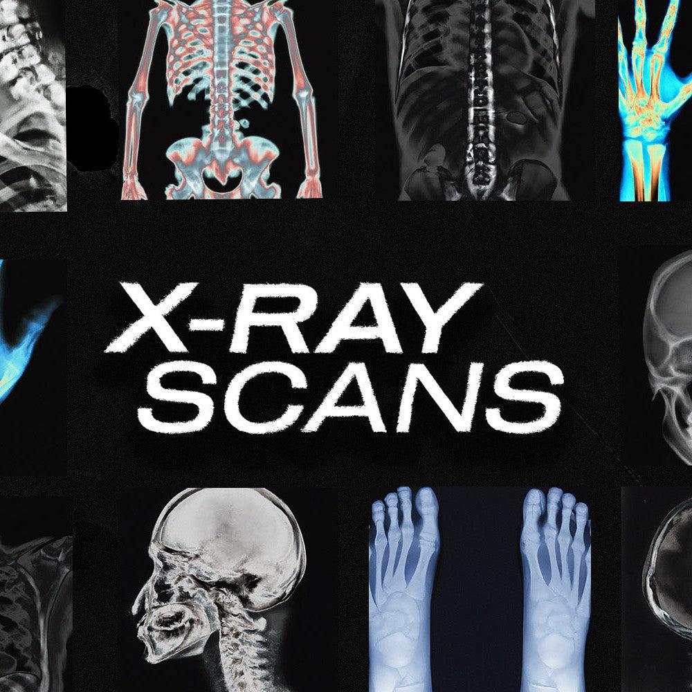 X-RAY SCANS