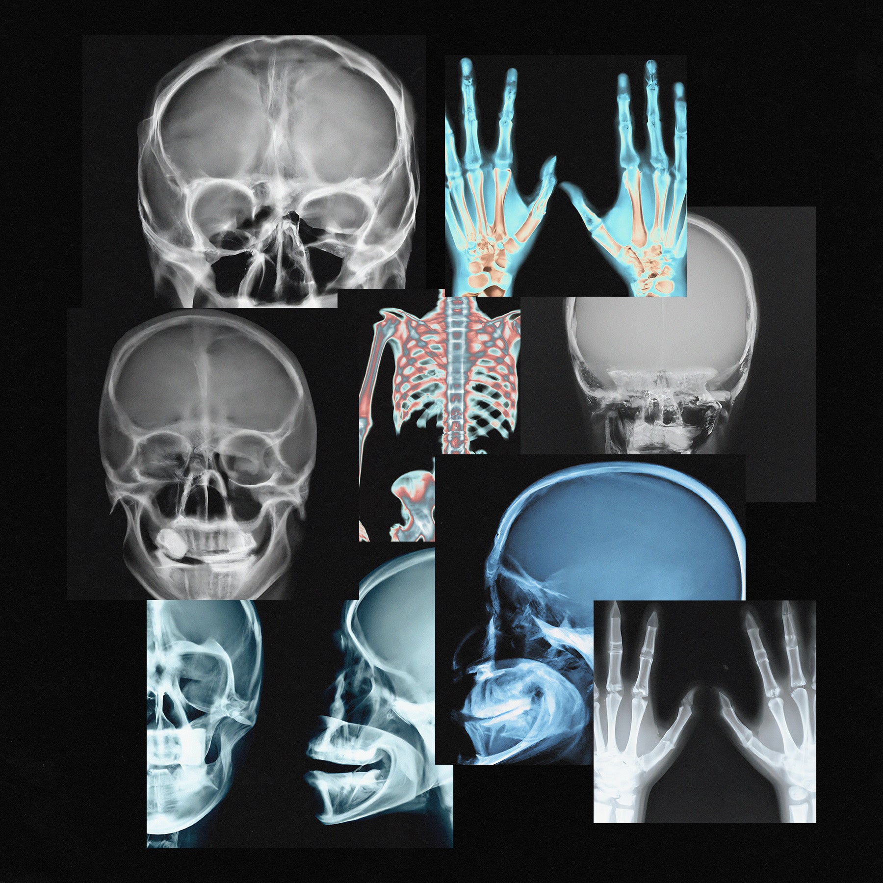 X-RAY SCANS