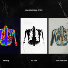 Hyper XRays