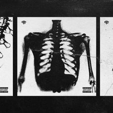 Hyper XRays