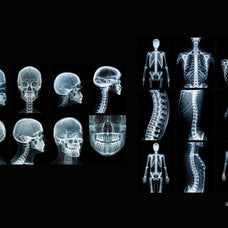Hyper XRays