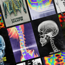 Hyper XRays
