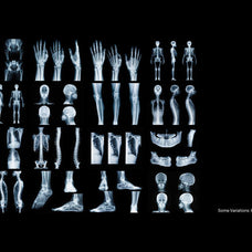 Hyper XRays
