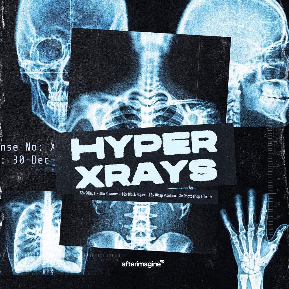 Hyper XRays