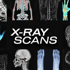 X-RAY SCANS